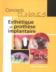 Esthétique et prothèse implantaire