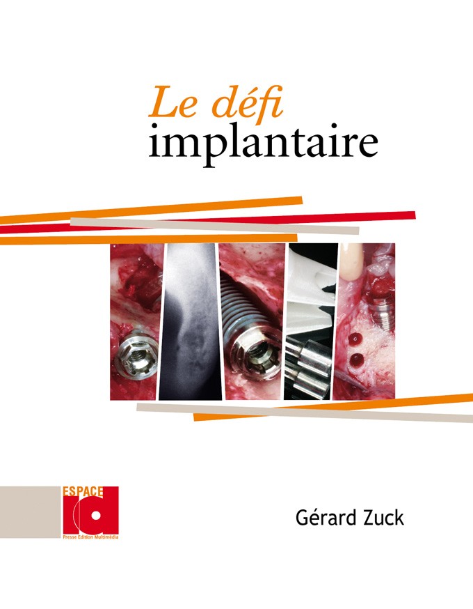 Le défi implantaire