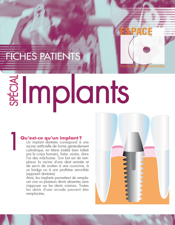 Fiche Patient : Spécial Implants 2ème édition