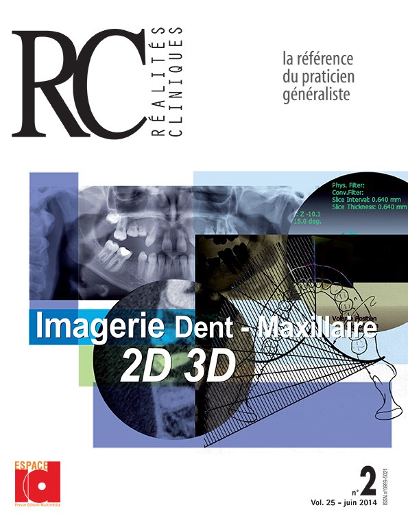 Imagerie Dent - Maxillaire 2D 3D