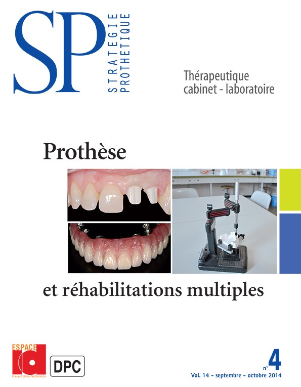Prothèse et réhabilitations multiples