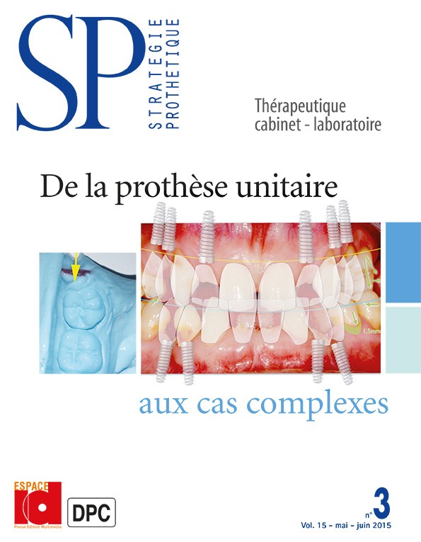 De la prothèse unitaire aux cas complexes
