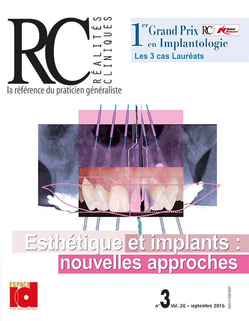 Esthétique et implants : nouvelles approches