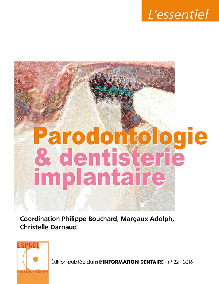 L'essentiel - Parodontologie et dentisterie implantaire