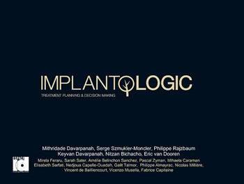 ImplantoLOGIC
