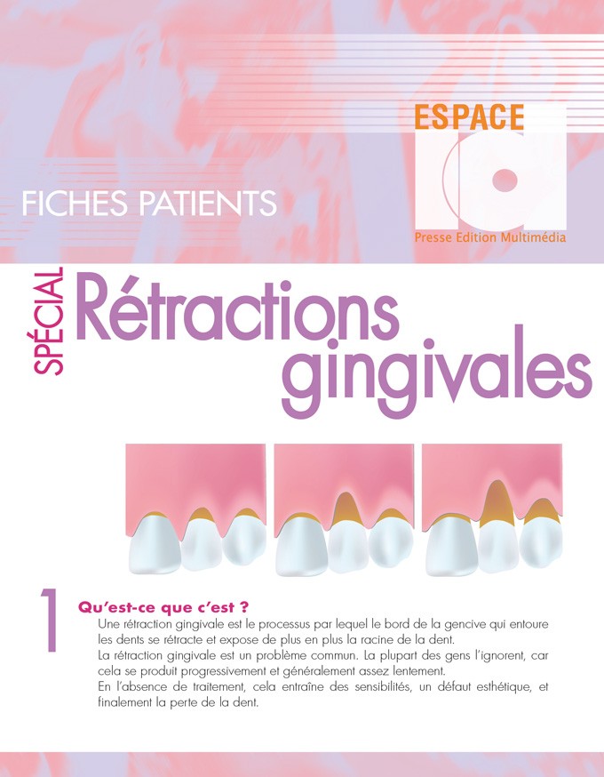 Fiche Patient : Rétractions gingivales