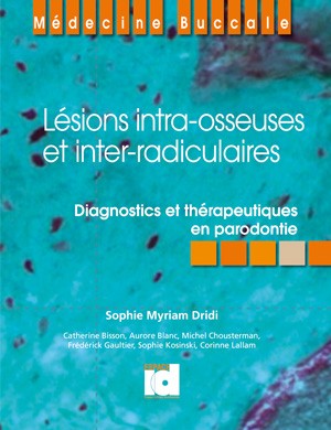 Lésions intra-osseuses et inter-radiculaires