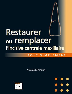 Restaurer ou remplacer l’incisive centrale maxillaire