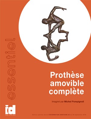 L'essentiel - Prothèse amovible complète