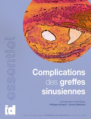 L'essentiel - Complications des greffes sinusiennes