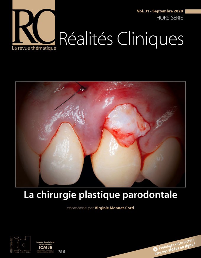 La chirurgie plastique parodontale - Hors-série 2020