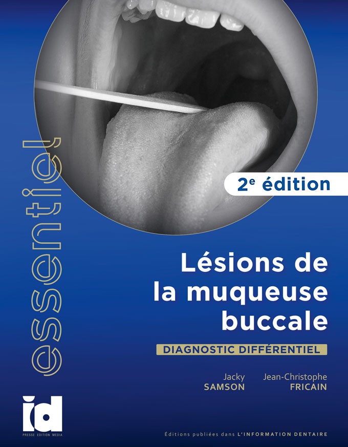 ESSENTIEL - Lésions de la muqueuse buccale Diagnostic différentiel - 2e édition