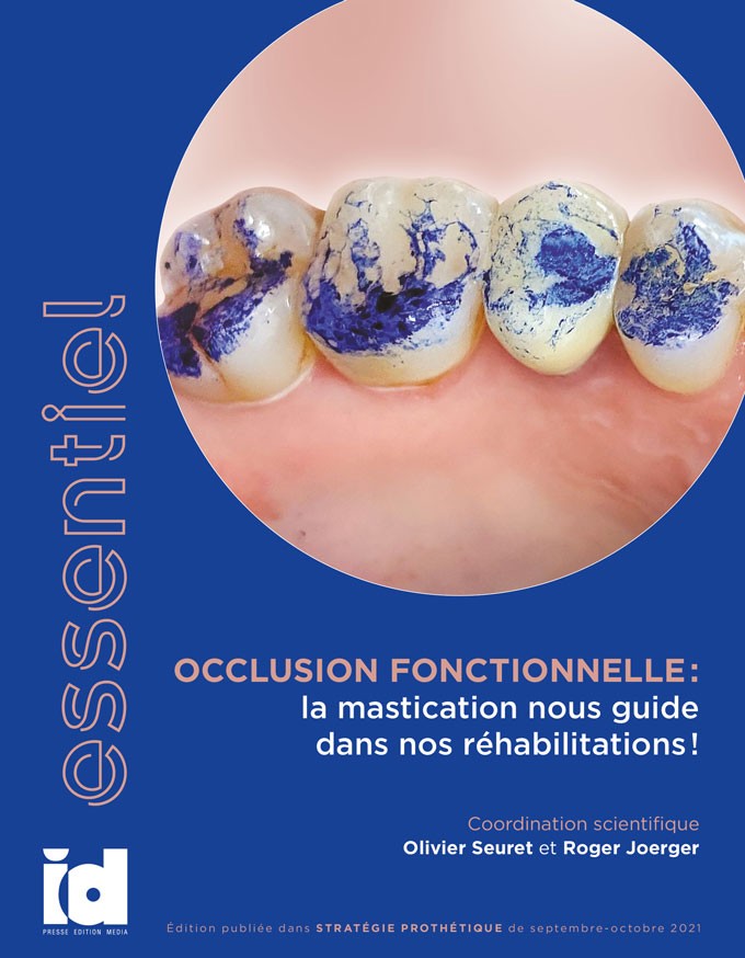 Essentiel - Occlusion fonctionnelle : la mastication nous guide dans nos réhabilitations !