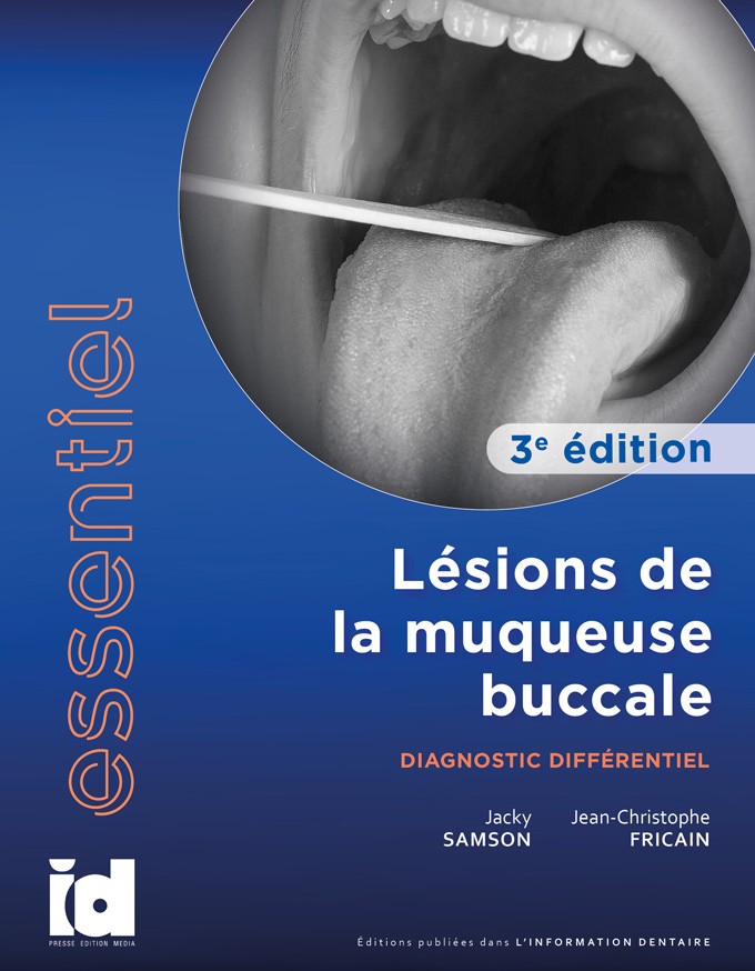 ESSENTIEL - Lésions de la muqueuse buccale<br/>Diagnostic différentiel<br/>3<sup>e</sup> édition