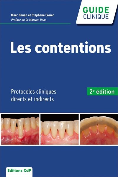 Les contentions 2e édition