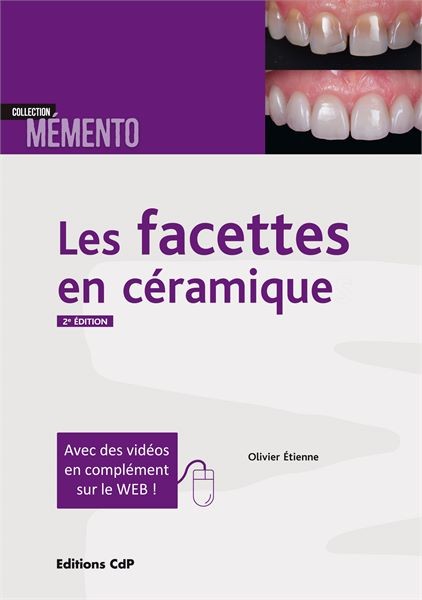 Les facettes en céramique 2ème édition